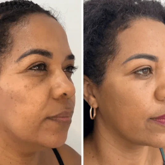 Solumi Skin™ Collagen Veil Mask – Korean Overnight Peel-Off Mask for Glass Skin Glow